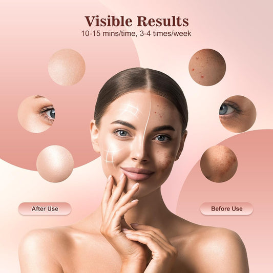 Woman with clear skin showing before and after effects of a skincare product on a pink background.